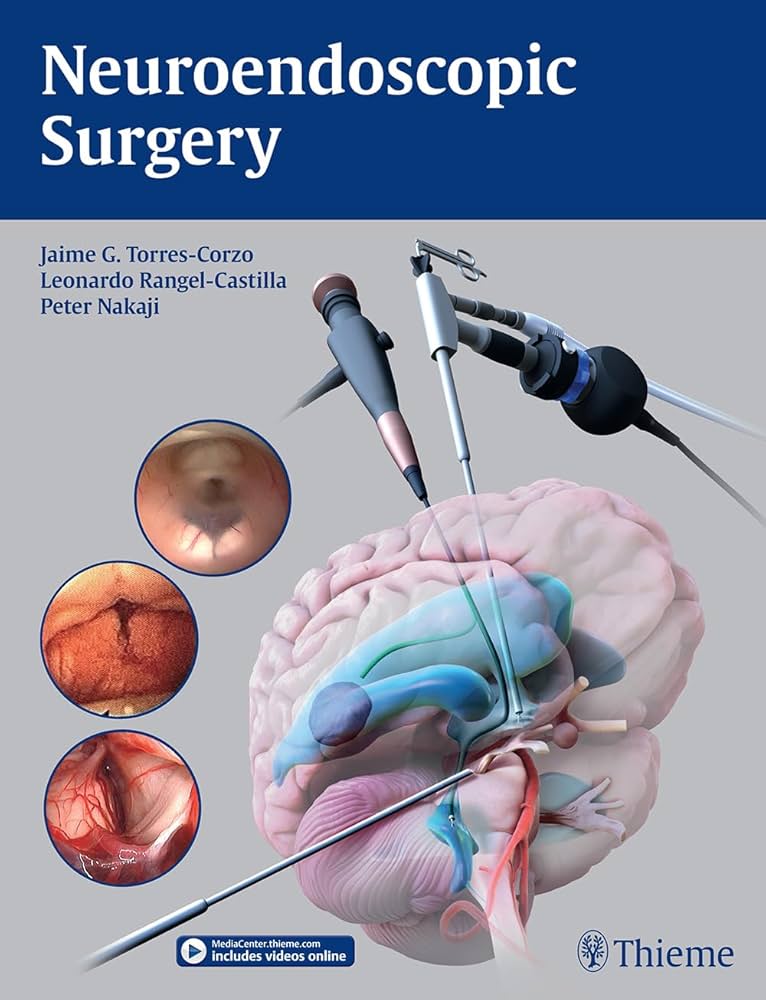 Neuroendoscopic Surgery: 9781684202218: Medicine & Health